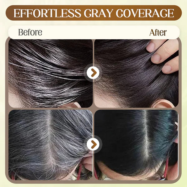 💇‍♀️ 🎉 Χτένα άμεσης βαφής μαλλιών για γκρίζα μαλλιά – Γρήγορη κάλυψη, φυτική φροντίδα και εύκολη χρήση ✨📦